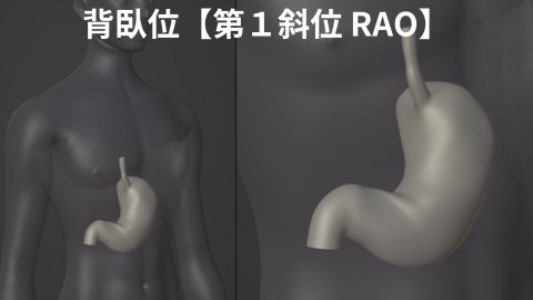 胃透視バリウム検査 背臥位RAO