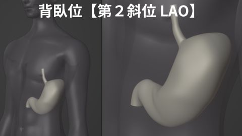 胃透視バリウム検査 背臥位LAO